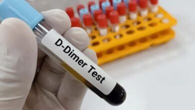 D-dimer test