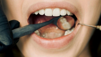 Everything You Need to Know About Cavities